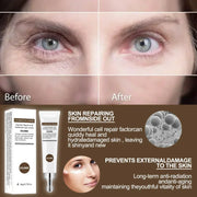 Anti-Aging Eye Cream: Dark Circles & Puffiness Care